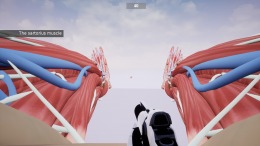 Shot the Body 